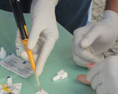 SCMJF aplica 1.400 testes gratuitos de Hepatite C (Data da publicacao)